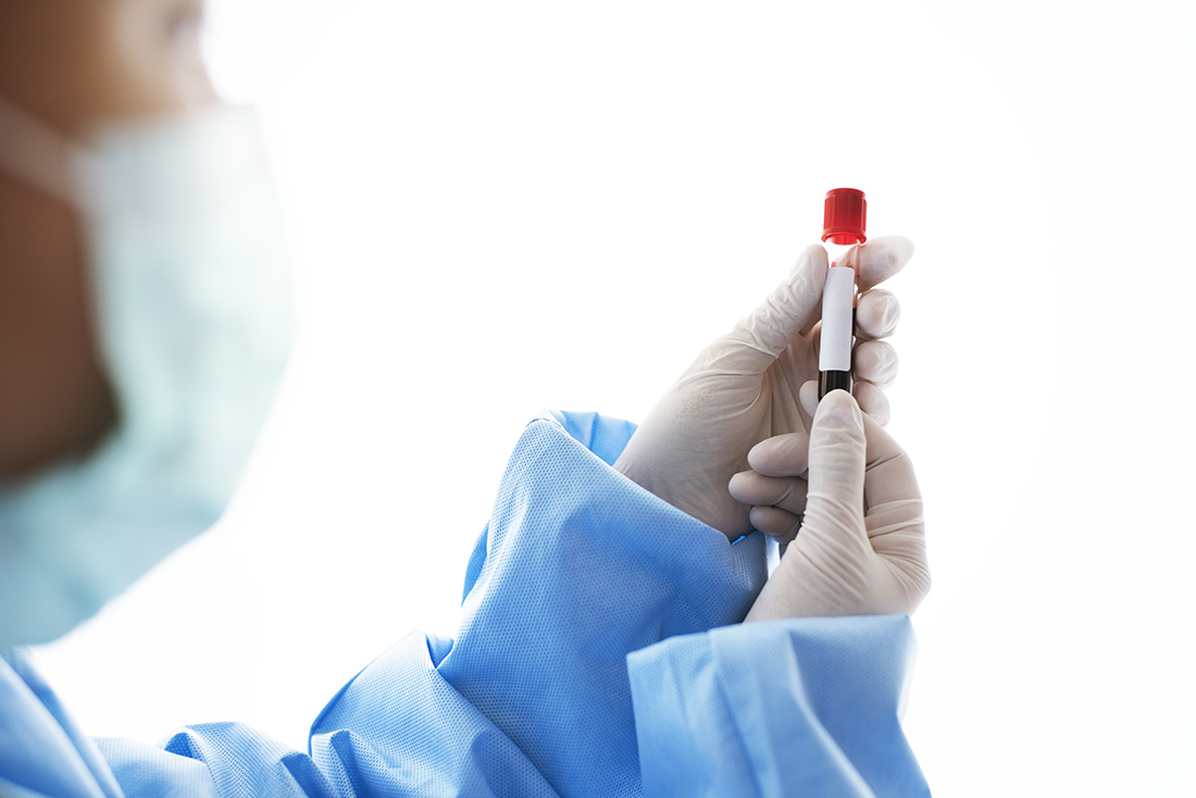 Read more about the article Como interpretar o exame de sangue?